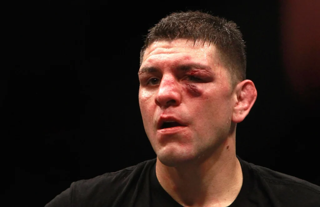 BREAKING UFC NEWS: Dana White announces Nick Diaz, Tony Ferguson return fights in Abu Dhabi
